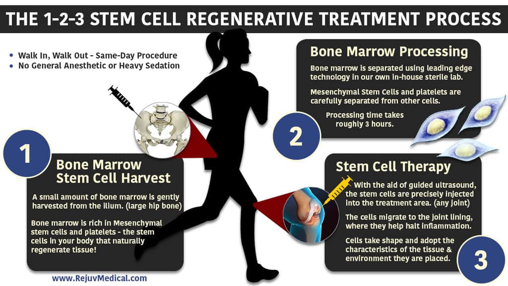 Regenerative-Stem-Cell-123-Infographic